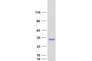 Proteasome Subunit alpha 4 (PSMA4) (Transcript Variant 1) protein (Myc-DYKDDDDK Tag)