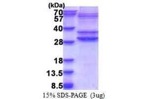 SDS-PAGE (SDS) image for PMF1-BGLAP Readthrough (PMF1-BGLAP) (AA 1-211) protein (His tag) (ABIN5853356) (PMF1-BGLAP Protein (AA 1-211) (His tag))