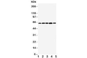 Western blot testing of BAG3 antibody;  Lane 1: MCF-7;  2: Jurkat;  3: A549;  4: HeLa;  5: COLO320 cell lysate.