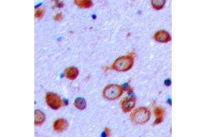 Immunohistochemical analysis of PTHR1 staining in human brain formalin fixed paraffin embedded tissue section. (PTH1R antibody  (Center))