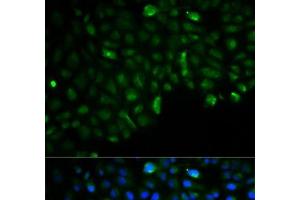 Immunofluorescence analysis of U2OS cells using HK2 Polyclonal Antibody (Hexokinase 2 antibody)