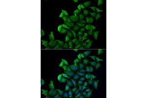 Immunofluorescence analysis of A549 cells using FABP5 antibody. (FABP5 antibody  (AA 1-135))