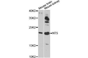 Western blot analysis of extracts of various cell lines, using NTS antibody (ABIN5998396) at 1:3000 dilution. (Neurotensin antibody)