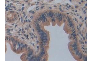 Detection of CASP12 in Mouse Uterus Tissue using Polyclonal Antibody to Caspase 12 (CASP12)