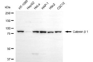 Western blotting analysis using catenin beta 1 antibody (ABIN7797931). (CTNNB1 antibody)