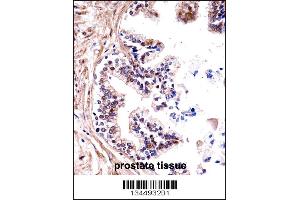 TMPRSS13 Antibody immunohistochemistry analysis in formalin fixed and paraffin embedded human prostate tissue followed by peroxidase conjugation of the secondary antibody and DAB staining.