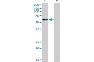 Western Blot analysis of TRAF6 expression in transfected 293T cell line by TRAF6 monoclonal antibody (M02), clone 1B2. (TRAF6 antibody  (AA 413-522))