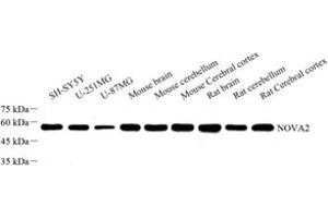 NOVA2 antibody