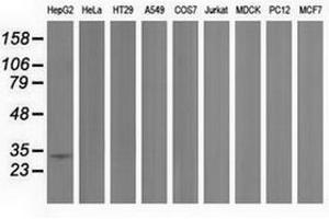 Image no. 1 for anti-Peroxisomal Trans-2-Enoyl-CoA Reductase (PECR) antibody (ABIN1500149) (PECR antibody)