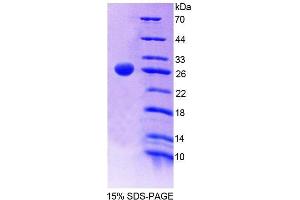 SDS-PAGE (SDS) image for CD6 (CD6) (AA 111-313) protein (His tag) (ABIN2124380) (CD6 Protein (CD6) (AA 111-313) (His tag))