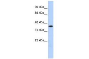 Image no. 1 for anti-Motor Neuron and Pancreas Homeobox 1 (MNX1) (AA 36-85) antibody (ABIN6740279) (MNX1 antibody  (AA 36-85))