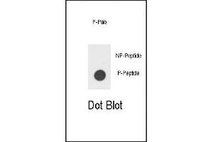 Dot blot analysis of anti-hIL3R-p Phospho-specific Pab (ABIN389580 and ABIN2839602) on nitrocellulose membrane. (CD131 antibody  (pTyr766))