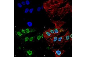 Immunocytochemistry/Immunofluorescence analysis using Mouse Anti-Cav3. (CACNA1G antibody  (AA 2052-2172) (HRP))