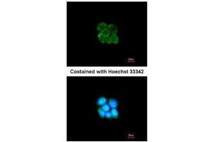 ICC/IF Image Immunofluorescence analysis of methanol-fixed A431, using SERPINF2, antibody at 1:200 dilution. (alpha 2 Antiplasmin antibody  (Center))