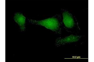 Immunofluorescence of purified MaxPab antibody to APPL2 on HeLa cell. (APPL2 antibody  (AA 1-664))