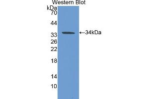 Western blot analysis of the recombinant protein. (CA5B antibody  (AA 34-317))