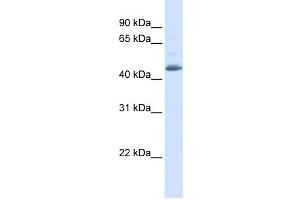 Western Blotting (WB) image for anti-Sorting Nexin 5 (SNX5) antibody (ABIN2459843) (SNX5 antibody)