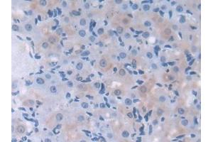 Immunohistochemistry (IHC) image for anti-Low Density Lipoprotein Receptor Adaptor Protein 1 (LDLRAP1) (AA 1-308) antibody (ABIN7440986)