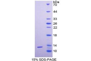 SDS-PAGE analysis of Human GCP2 Protein. (GCP2 Protein)