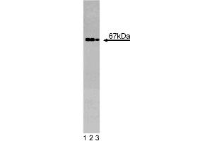 Western blot analysis of GGA2 on a EB-1 cell lysate (Human B lymphoblast, Burkitt's lymphoma, ATCC HTB-60). (GGA2 antibody  (AA 334-445))