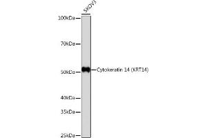Western blot analysis of extracts of SKOV3 cells, using Cytokeratin 14 (KRT14) (KRT14) antibody (ABIN7268091) at 1:1000 dilution. (KRT14 antibody)