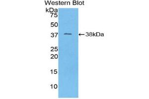 Western blot analysis of the recombinant protein. (MT-ND1 antibody  (AA 122-171))