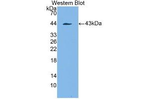 Figure. (PDGFRL antibody  (AA 22-375))