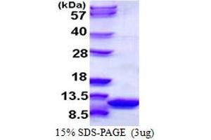 SDS-PAGE (SDS) image for S100 Calcium Binding Protein A6 (S100A6) (AA 1-89) protein (His tag) (ABIN667473) (S100A6 Protein (AA 1-89) (His tag))