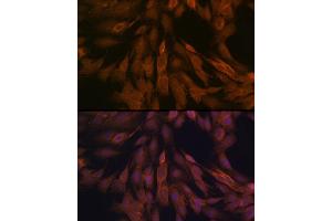Immunofluorescence analysis of C6 cells using ULK3 Rabbit mAb (ABIN7271222) at dilution of 1:100 (40x lens). (ULK3 antibody)