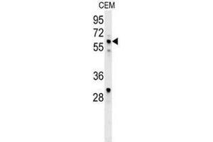 Western blot analysis in CEM cell line lysates (35ug/lane) using IKZF1/IKAROS Antibody (C-term). (IKZF1 antibody  (C-Term))