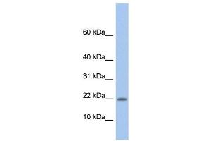 NDP antibody used at 1 ug/ml to detect target protein. (Norrie Disease (Pseudoglioma) antibody)