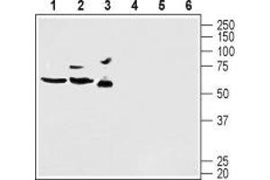 Western blot analysis of mouse brain lysate (lanes 1 and 4), rat brain lysate (lanes 2 and 5) and human U-87 MG glioblastoma cell lysate (lanes 3 and 6): - 1-3. (KCND2 antibody  (C-Term, Intracellular))