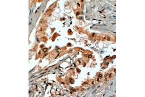 ABIN185346 (4µg/ml) staining of paraffin embedded Human Prostate. (SRD5A1 antibody  (N-Term))