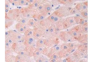 DAB staining on IHC-P; Samples: Human Liver Tissue (LGALS9B antibody  (AA 17-148))