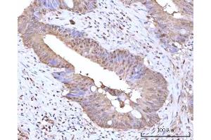 IHC analysis of RNGTT using anti-RNGTT antibody (ABIN7599723). (RNGTT antibody  (AA 11-438))