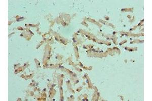 Immunohistochemistry of paraffin-embedded human prostate tissue using ABIN7149007 at dilution of 1:100 (CST1 antibody  (AA 20-141))