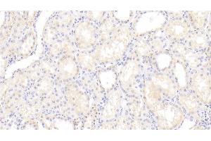 Detection of VASN in Human Kidney Tissue using Polyclonal Antibody to Vasorin (VASN) (Vasn antibody  (AA 298-539))