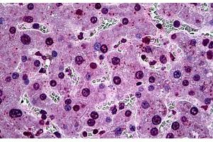 Human Liver: Formalin-Fixed, Paraffin-Embedded (FFPE) (SGK1 antibody  (AA 1-91))