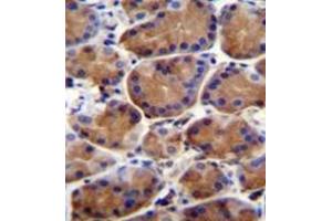 Immunohistochemistry analysis in formalin fixed and paraffin embedded human stomach tissue reacted with LRWD1 Antibody (N-term) followed which was peroxidase conjugated to the secondary antibody and followed by DAB staining. (LRWD1 antibody  (N-Term))