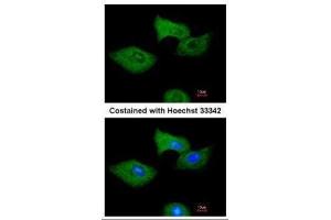 ICC/IF Image Immunofluorescence analysis of methanol-fixed A549, using RGS2, antibody at 1:200 dilution. (RGS2 antibody)