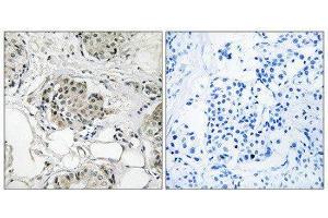 Immunohistochemistry (IHC) image for anti-Ubiquitin Specific Peptidase 13 (Isopeptidase T-3) (USP13) (C-Term) antibody (ABIN1852328) (USP13 antibody  (C-Term))