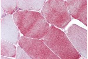 Anti-FABP3 antibody IHC staining of human skeletal muscle.