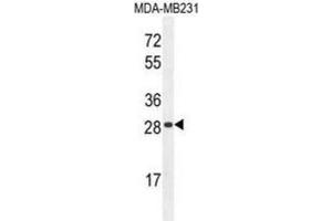 Western Blotting (WB) image for anti-Haptoglobin Related Protein (HPR) antibody (ABIN2996022)