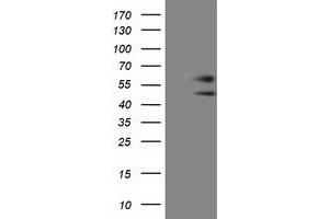HEK293T cells were transfected with the pCMV6-ENTRY control (Left lane) or pCMV6-ENTRY C9orf41 (Right lane) cDNA for 48 hrs and lysed. (C9orf41 antibody)