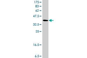 Western Blot detection against Immunogen (37 KDa) . (GPT2 antibody  (AA 358-456))