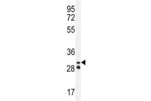 Neutrophil elastase antibody western blot analysis in A2058 lysate. (ELANE antibody  (AA 13-39))