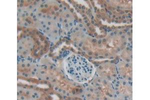 Used in DAB staining on fromalin fixed paraffin- embedded Kidney tissue (Sonic Hedgehog antibody  (AA 237-399))