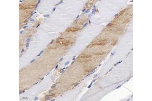 Immunohistochemistry analysis of paraffin-embedded rat skeletal muscle using SLC6A8 (ABIN7075678) at dilution of 1: 400 (SLC6A8 antibody)