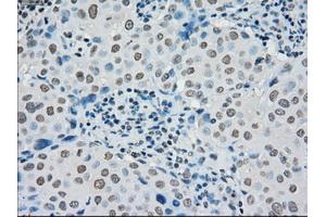 Image no. 2 for anti-Premelanosome Protein (PMEL) antibody (ABIN1500300) (Melanoma gp100 antibody)