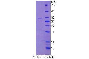 SDS-PAGE analysis of Human FIBP Protein. (FIBP Protein)